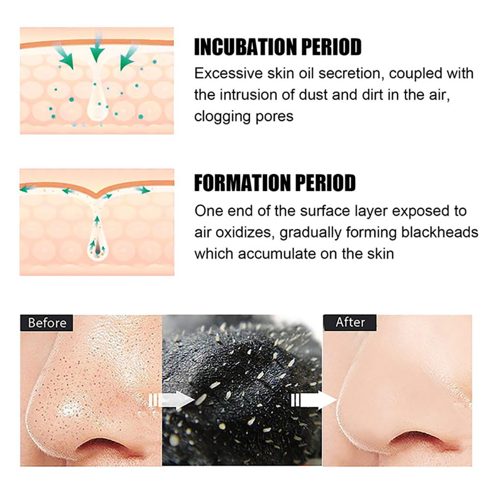 10/20/50/100PCS Nose Blackhead - огляд і ціна Charcoal Pore Strip