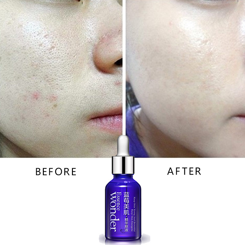 BIOAQUA Blueberry Face Lifting - огляд і ціна Skincare Bioaqua