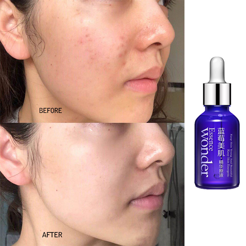 BIOAQUA Blueberry Face Lifting - огляд і ціна Skincare Bioaqua