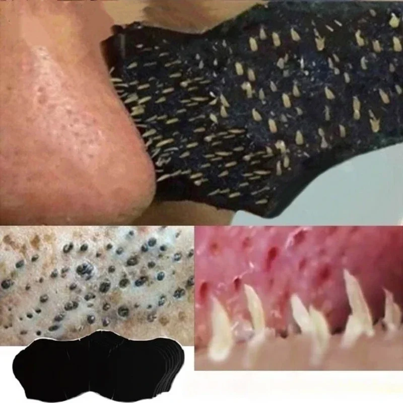 Unisex Blackhead Remove Mask N - огляд і ціна Charcoal Pore Strip
