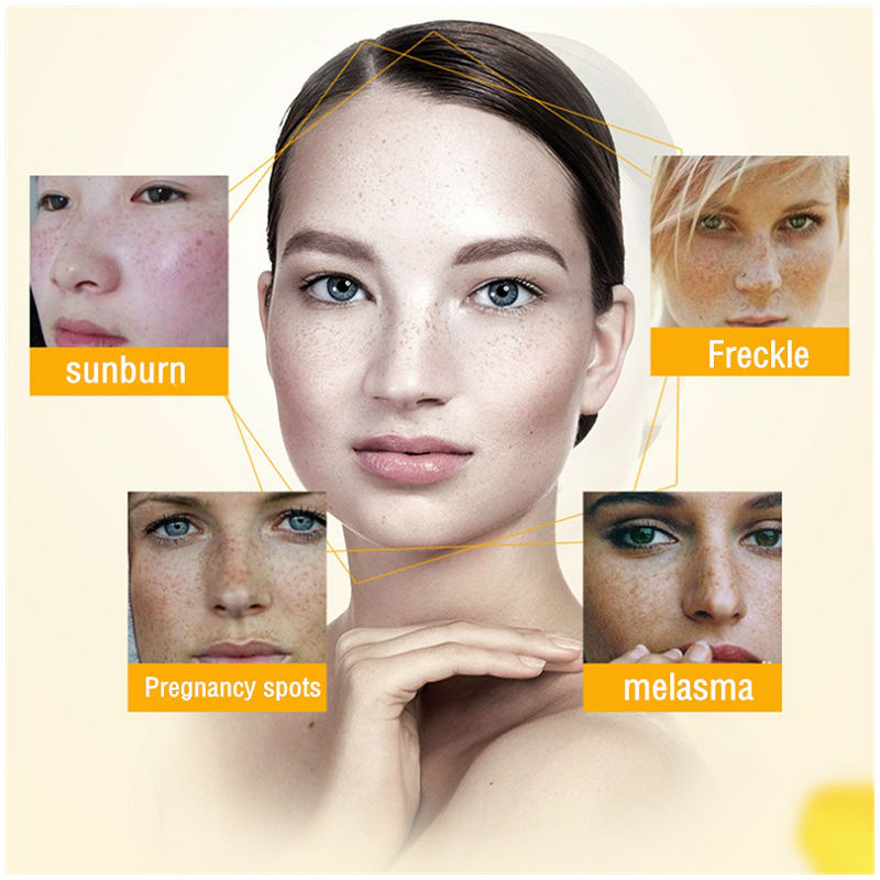 Dimollaure Whitening Freckle C - огляд і ціна Skincare Herbal