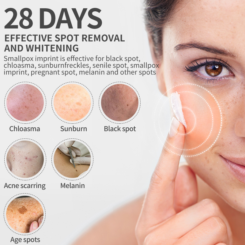 Dimollaure Whitening Freckle C - огляд і ціна Skincare Herbal